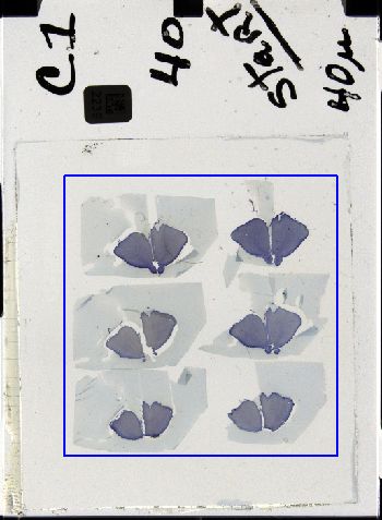 Media type: image; histological serial section;  shows cataloged_item Special Collections 3298